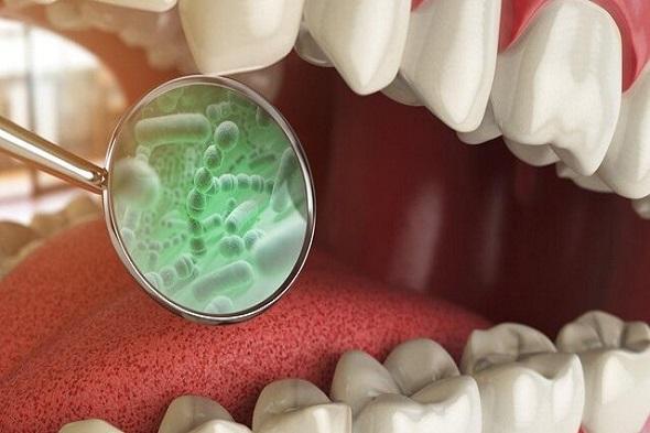 تاثیر باکتری های دهانی بر افزایش التهاب روده
